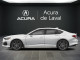 2025 Acura TLX - Thumbnail 1
