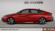 2025 Hyundai Elantra - Thumbnail 2