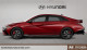 2025 Hyundai Elantra - Thumbnail 2