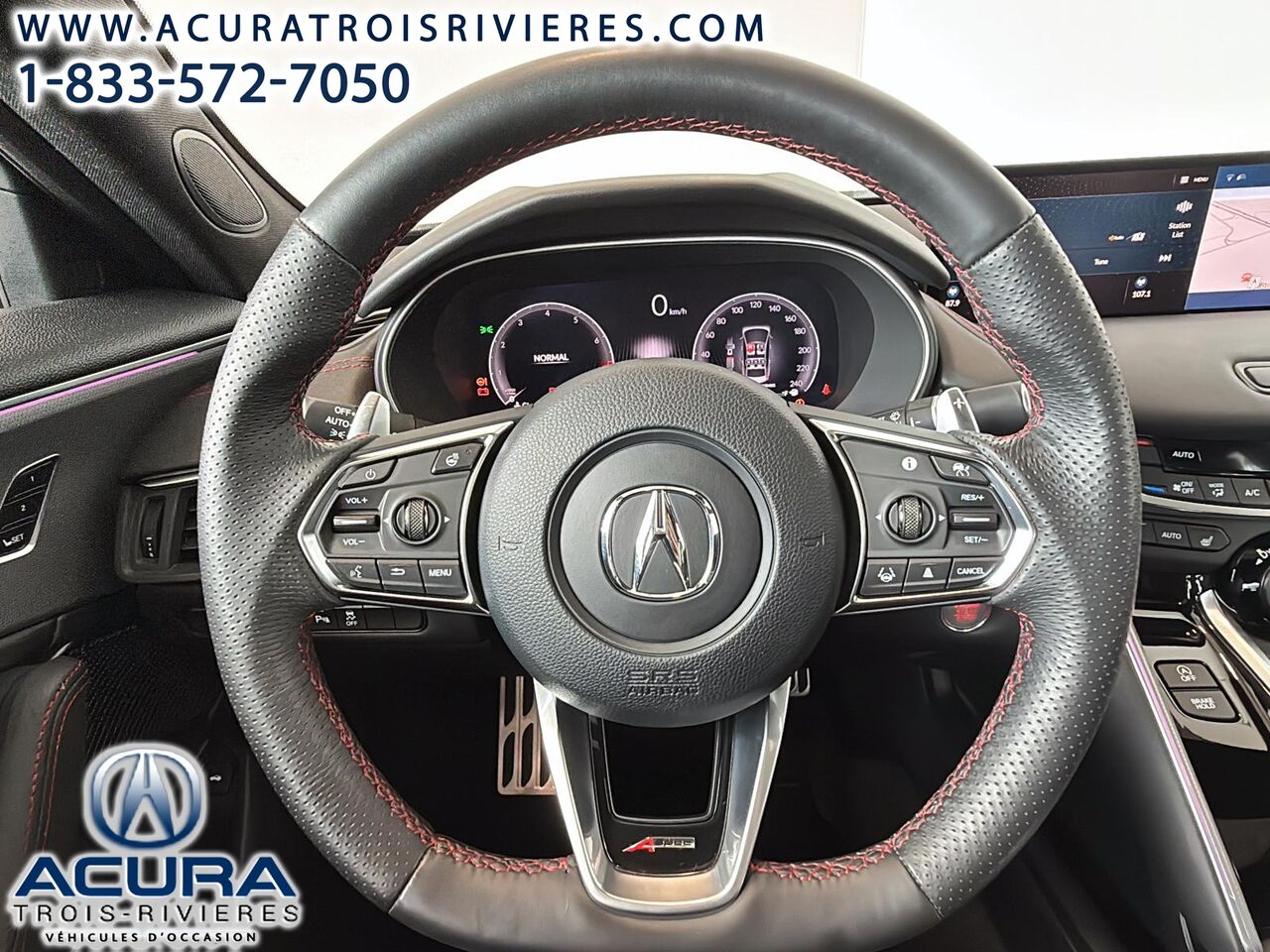 2025 Acura TLX - Image 15