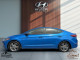 2017 Hyundai Elantra - Thumbnail 5
